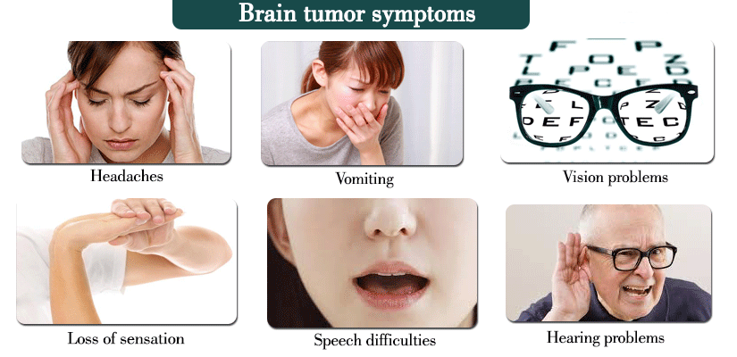 Brain tumor symptoms.