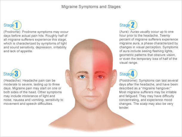 Migraine Symptoms